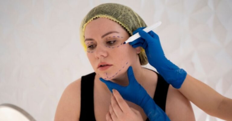 SkinPen Microneedling
